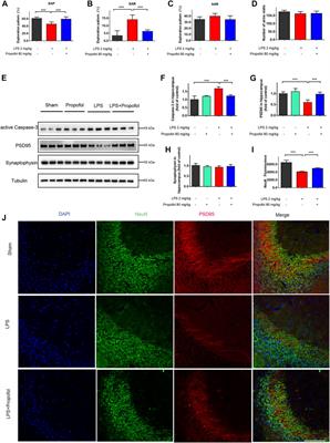 Propofol inhibits neuroinflammation and metabolic reprogramming in microglia in vitro and in vivo